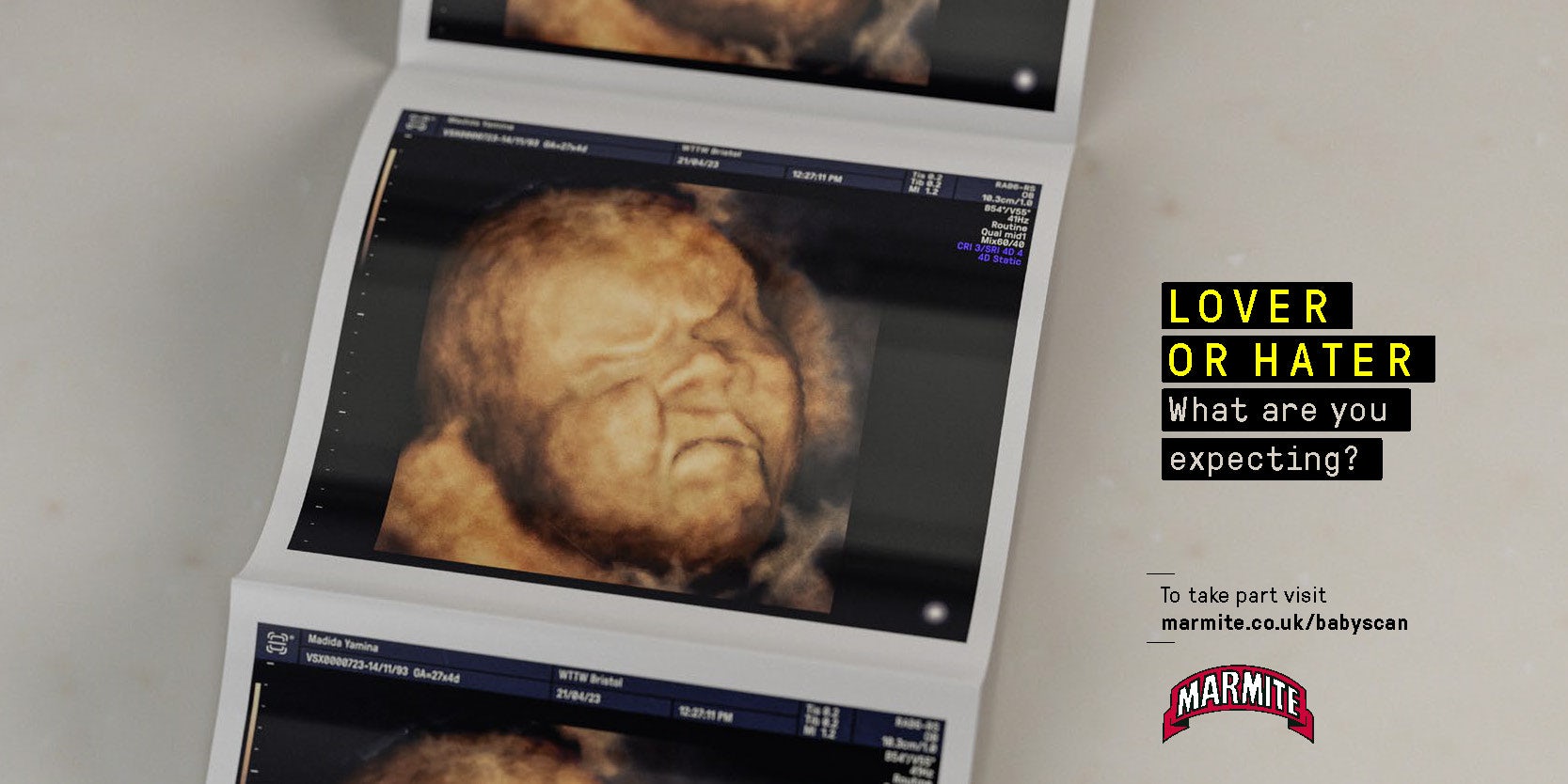 Image shows a Marmite ad featuring an ultrasound scan of a foetus appearing to frown