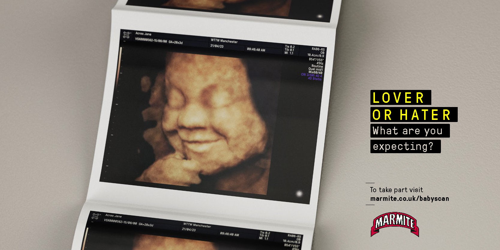 Image shows a Marmite ad featuring an ultrasound scan of a foetus appearing to stroke its chin