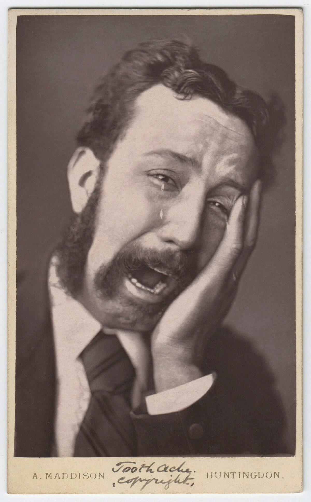 Sepia toned photo of a person with a moustache and wearing a suit and tie, apparently in tears clutching their jaw in pain