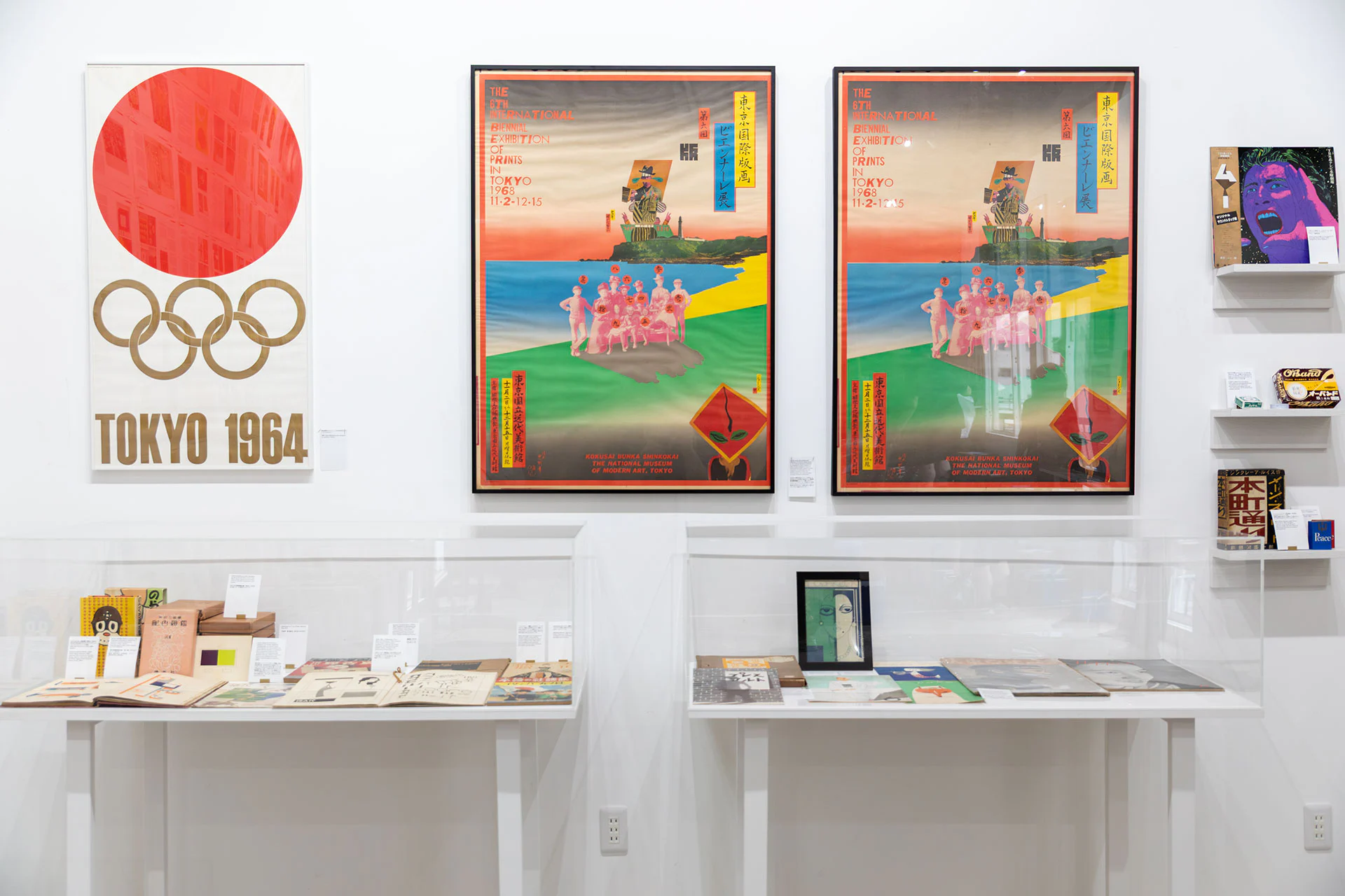 Fracture installation view