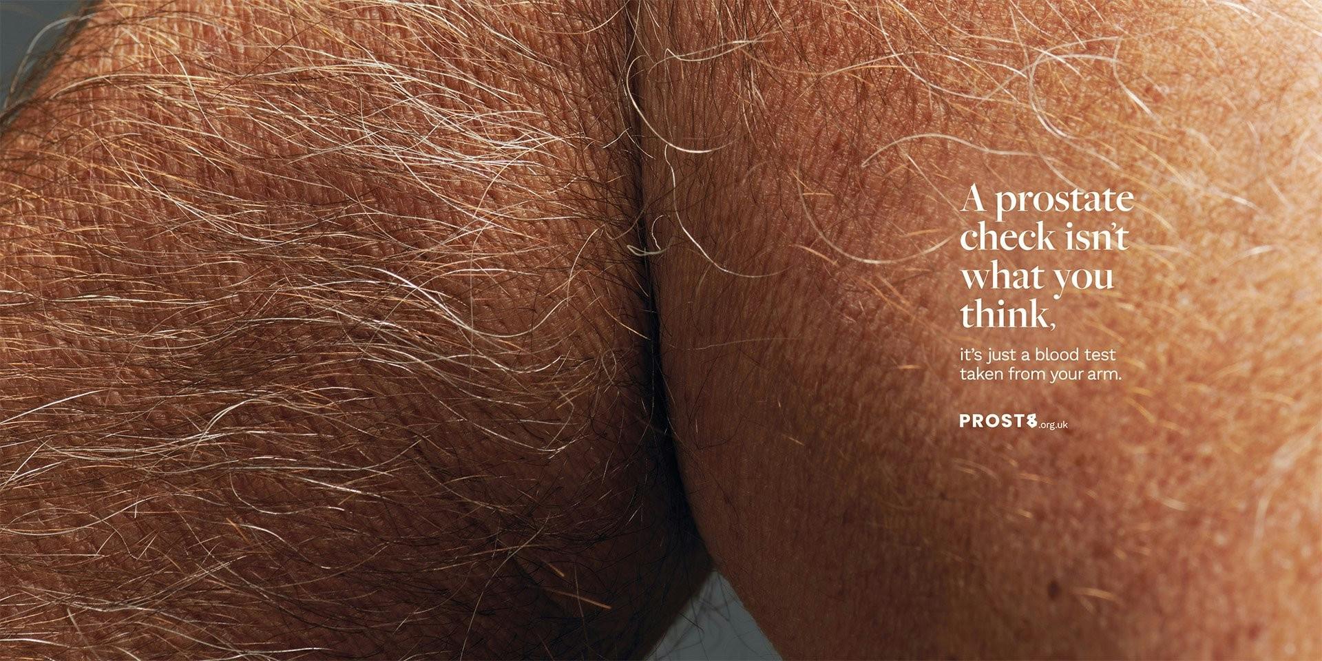 TBWA\MCR Prost8